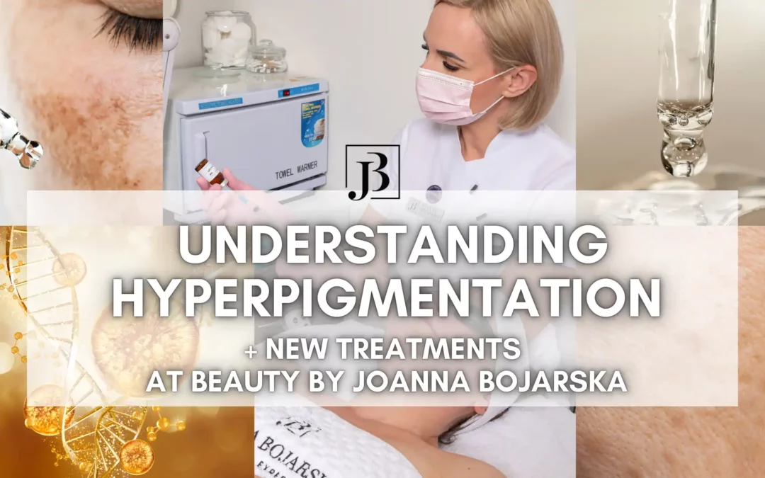 Understanding Hyperpigmentation - Blog - Joanna Bojarska Beauty Expert