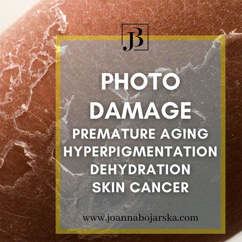 Photo damage - Sun protection - Blog - Joanna Bojarska - Beauty Expert